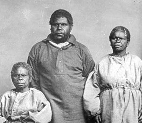 男子被解剖展览,妻子留遗愿别展览我!却仍被送博物馆展览98年