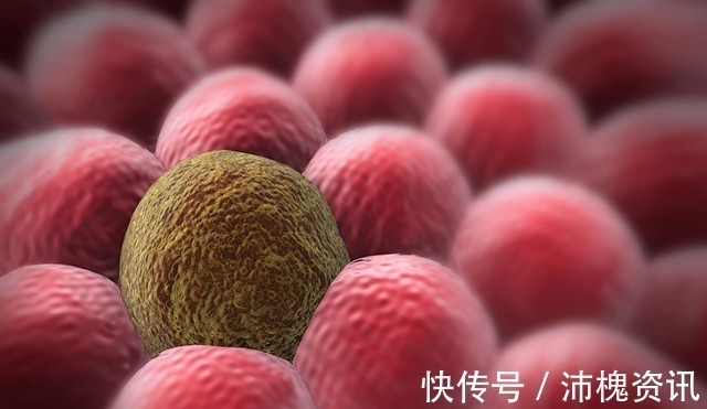 油腻食物|消化科有慢性胃炎,一个“土方”熬水,养好胃,不复发