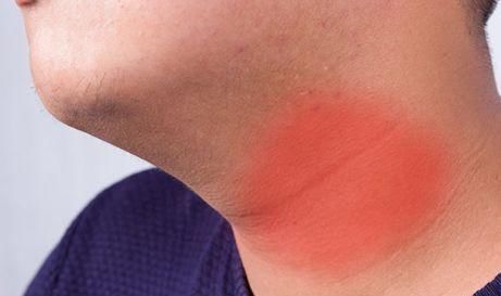 咖啡|甲状腺出现结节的人,3种食物在喜欢吃也不要碰,不然会加重结节