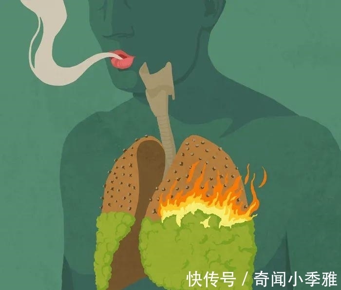 加西亚$终于读懂了，艺术家亲自解读讽刺性插画，让人恍然大悟