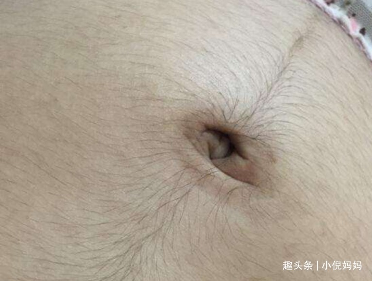 琳琳|孕妇肚子上有“黑线”生男孩别再听信谣言,正确的说法是这样