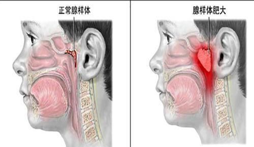 小时候|为什么有的人小时候好看,长大后却变丑了?真相太扎心了