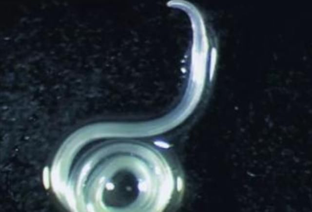 肚子|只要在鱼肚子里看到这东西,立马停筷,小心引发胃穿孔,肚子长虫