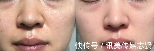 平价|平价护肤品也能很好用,分夏季款自用护肤品,用途多,效果好!