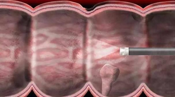 小知识|为什么发现癌症总是晚期,只是因为每年体检方式不对!你清楚吗?