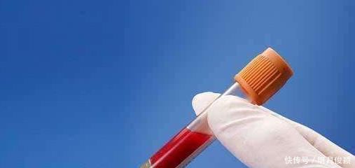 血糖高就不能吃水果吗平时常吃5种水果,对高血糖患者好处多