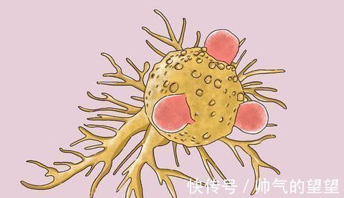 繁殖|癌症患者做完手术,已经把肿瘤切干净了,为何之后却还是复发了