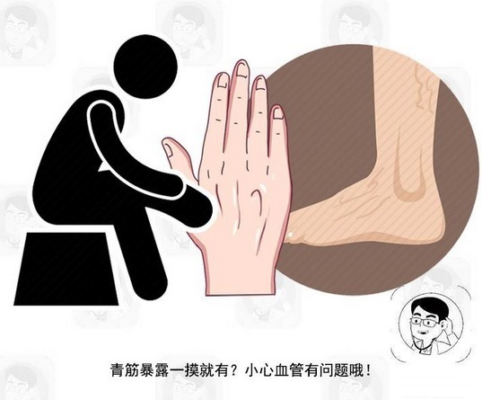 动脉|血管堵没堵,摸一摸5个部位就知道!占两个,要警惕血栓