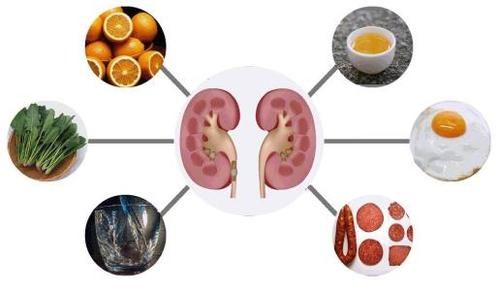 得了结石疼痛难忍？靠这样调节饮食，可以防治结石，减少复发率