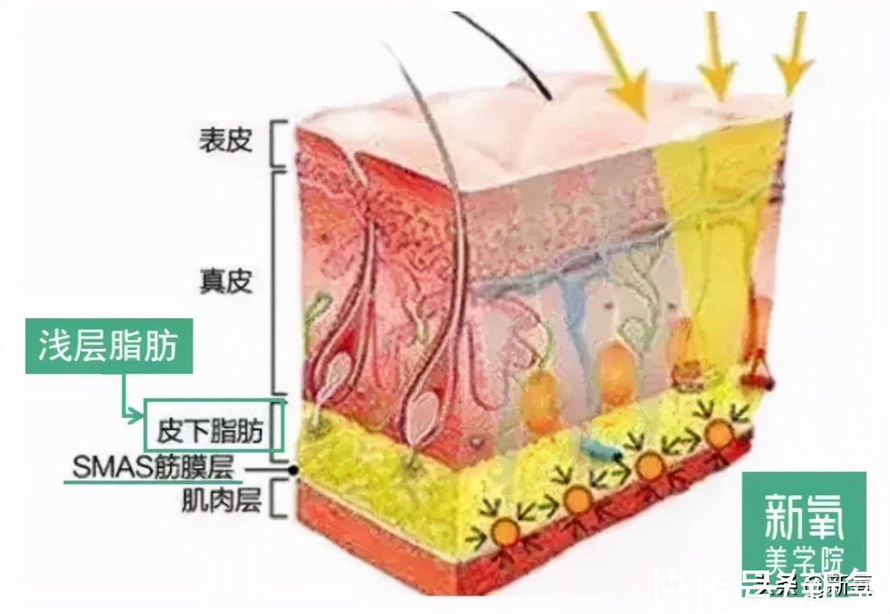 真皮层|为什么在抗衰这件事上，她们越努力越不行？