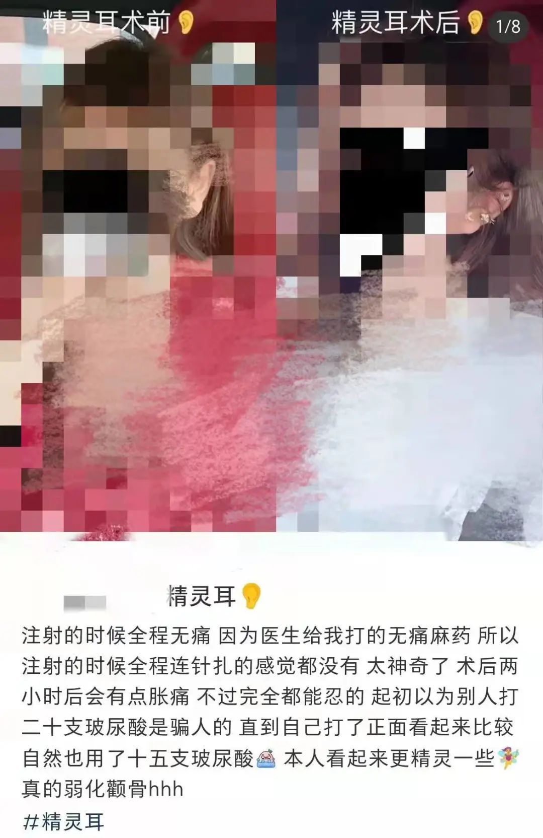 焦虑 离谱！外貌焦虑已经“卷”到动物身上了