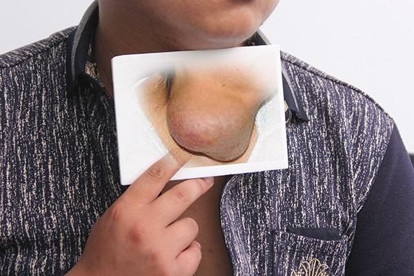 标志物|肿瘤标志物超正常10倍，吓坏女士，检查结果却是正常？为什么？