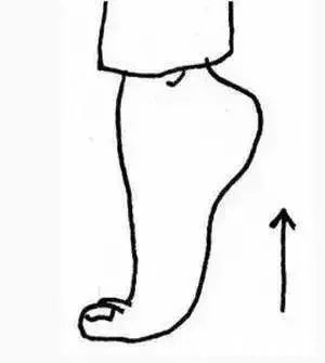 女子|43岁女子,头晕眼发黑,查出脑梗,只因一种“零嘴”吃太多