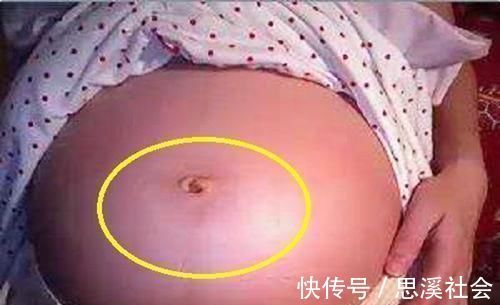 肚子|孕妈肚脐凸比凹好?别自己吓自己,区别倒是有,真相孕妈要了解