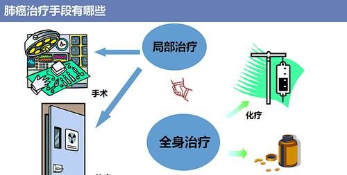 晚期肺癌常见的5个治疗误区，知道这些或可救命