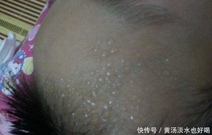 找上门|孩子身上2个部位出汗多，是脾胃在“求救”，警惕脾虚找上门