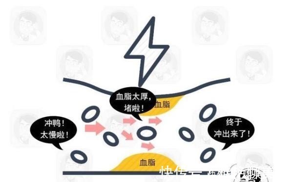 肩膀|心梗来袭，肩膀先知肩膀出现这个现象，是血管在向你“求救”