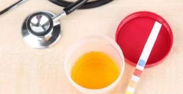 痛风|70-79岁是“长寿关键期”，要健康更长寿，做到：3防，4勤