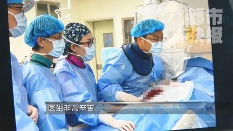 卵圆孔未闭|男子头疼光吃止疼药,一查竟是脑出血,医生:这种头疼千万警惕!