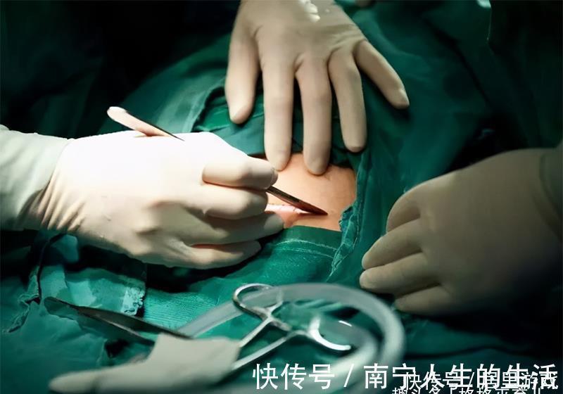 伤口|第二次剖腹产和第一次剖腹产有什么不同?如何身体会恢复的更好?