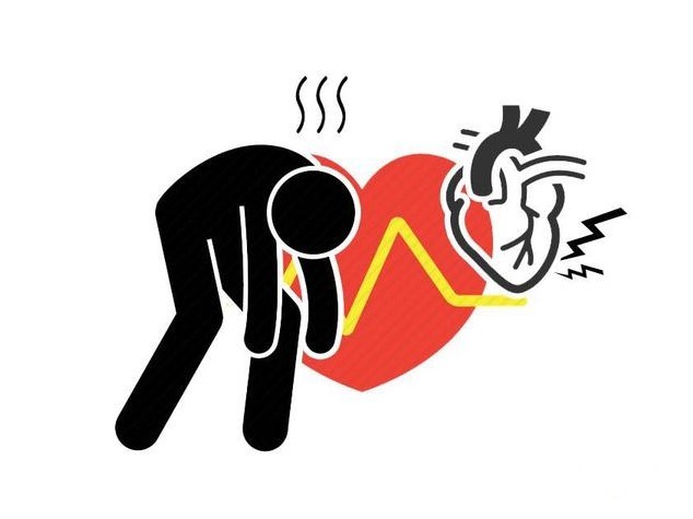 心电图|怀疑自己得了心脏病,要做哪些检查?3种检查方法,不妨了解下