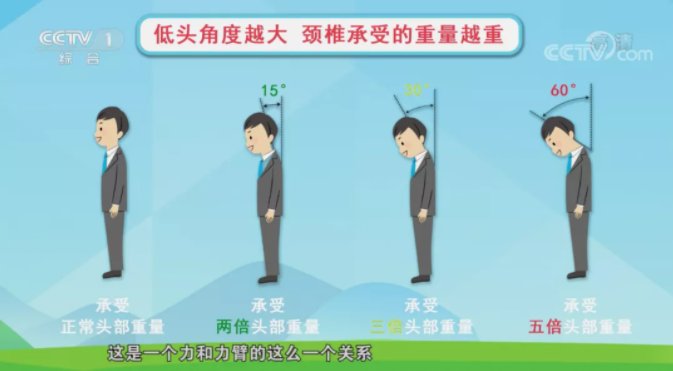 颈椎|警惕！这些不良生活习惯正在伤害你的颈椎