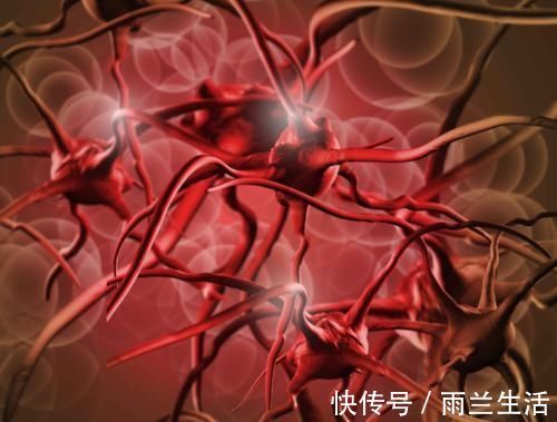 血栓|血管堵塞无小事！不妨试试这3个动作，帮你冲走血栓，疏通血管