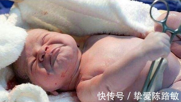 小宝宝|刚剖腹出来的宝宝伸手抓住医生的剪刀,不让剪断脐带!
