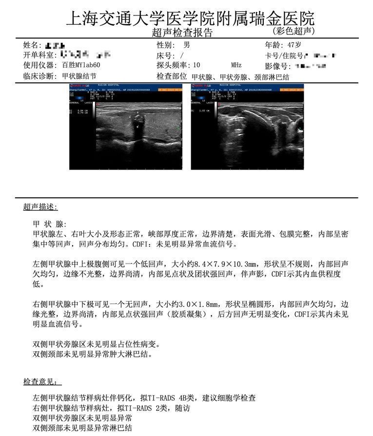  结节|七个问答，全面了解甲状腺结节