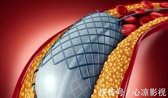 耳鸣|“降压冠军”已找到,不是山楂,没事吃两口,血压或波澜不惊