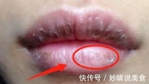 女性朋友|有妇科疾病的女人，嘴巴可能有4种表现，你若没有，身体很健康