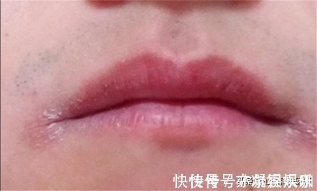 维生素b2|几块钱一瓶的维生素B2却是高血压的“克星”!大多数人都不知道