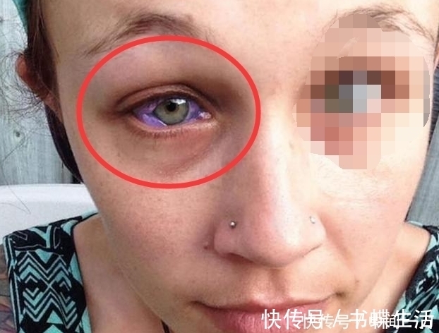 紫色|国外一女子,哭出来的是紫色眼泪,医生查出真相原因是纹身