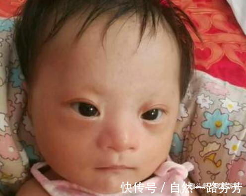 唐氏|“唐氏宝宝”越来越多,诱因多半源于父母,这3种孕妈难逃噩运