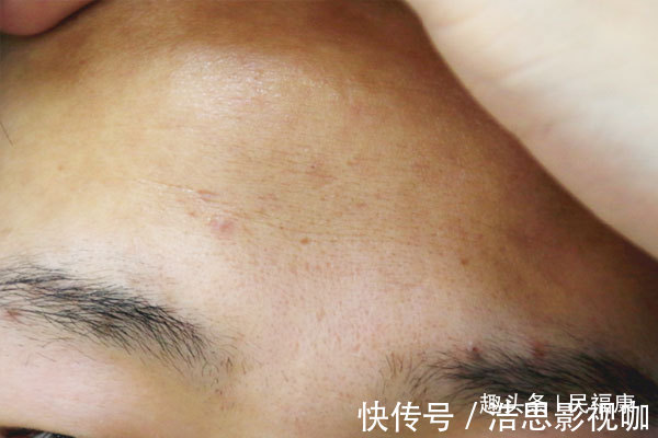 女性|子宫干净的女性,脸上不会出现3种症状,若占一种,别忽视