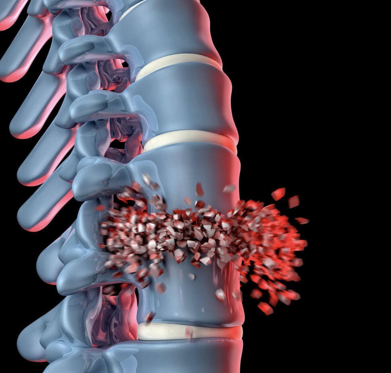 公开|医生公开这“三类”疾病都不算病，即使人老了也无需过度治疗