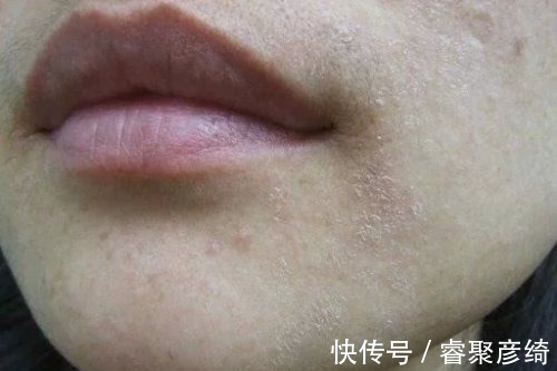 洗脸|为什么我的爽肤水不好用？