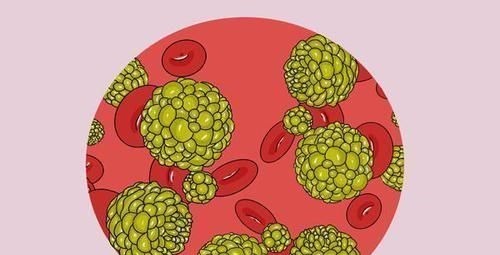 患者|得了肺癌,究竟还能活多久熬过五年生存期,是不是就安全了