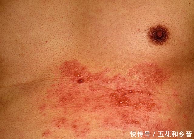 好坏|俗话说“一个榴莲顶3只鸡”,医生建议无论好坏,4类人少吃榴莲