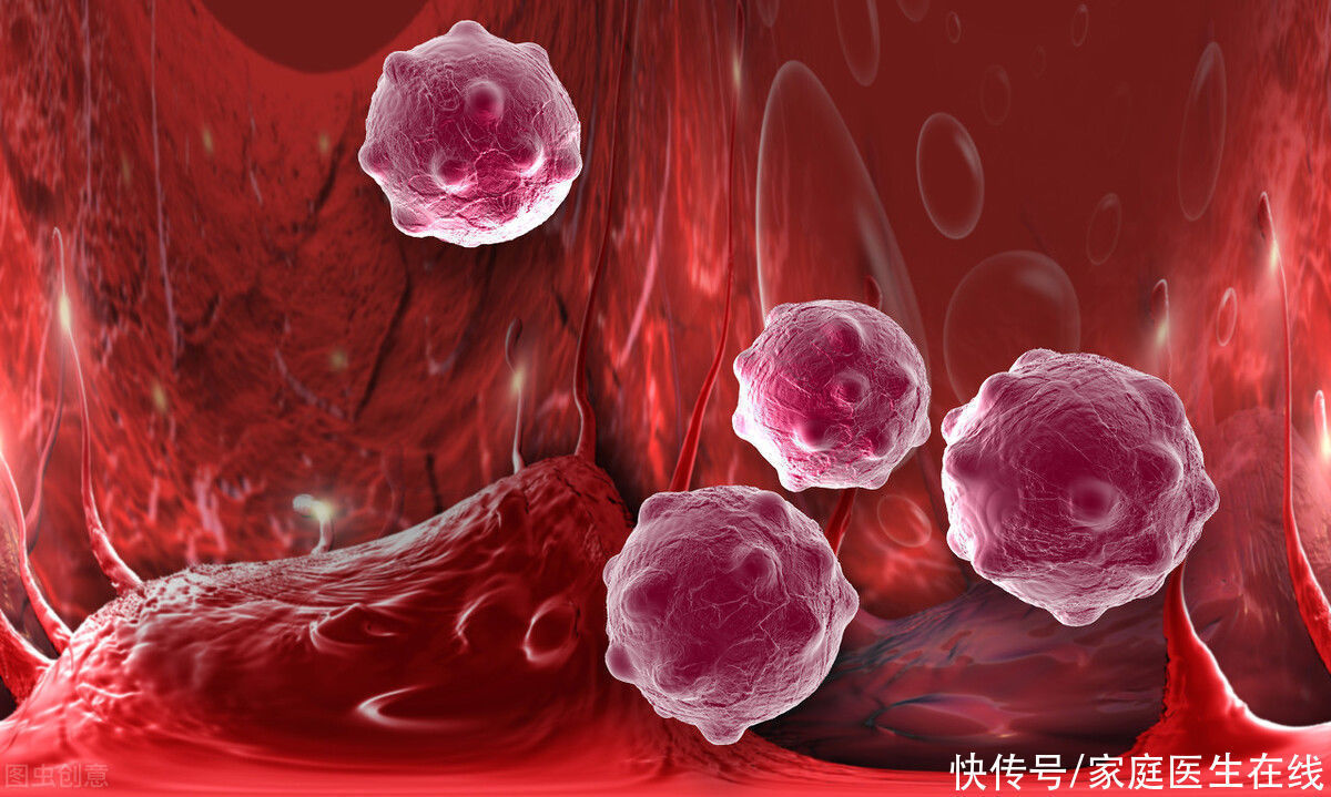 患癌|有时节省并不是好事？注意，这4个不正确的节省习惯会增加得癌症的风险