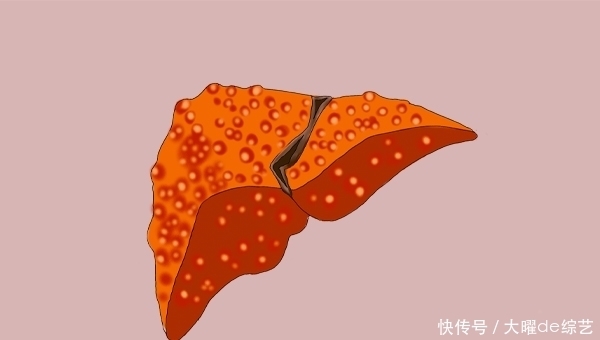 被世卫组织列为第一类致癌物,与烟草同级别,你知道哪些?