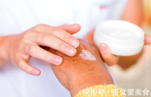 皮炎|湿疹、皮炎,擦什么好得快?常见皮肤病“用药指南”,一看就会