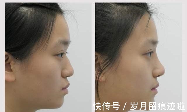对手术 12种不适合做整形手术的行为，其中4种已被医生列入“黑名单”！