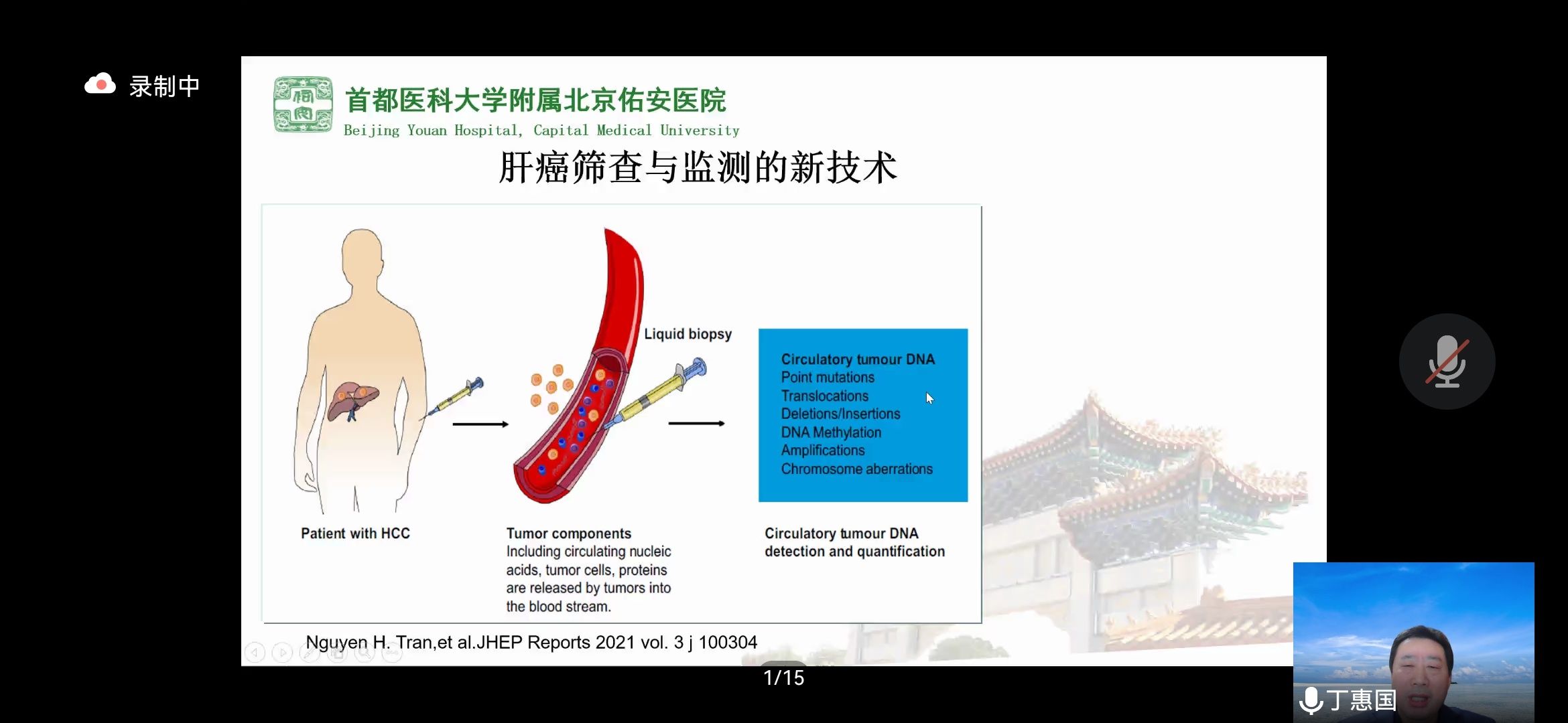 原发性肝癌|丁惠国教授《原发性肝癌高危人群的分层筛查与监测：临床实践》