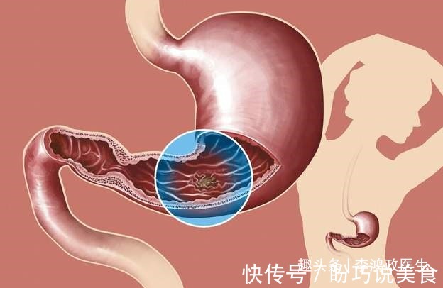 妇科医生|女子头晕半年,以为患癌症,检查结果让她觉得重获新生