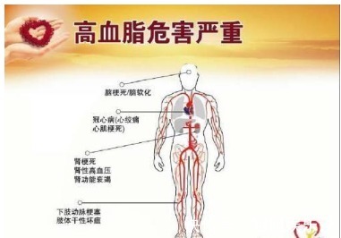 高血压|高血压会影响我们的寿命辟谣有效控制血压，高血压人照样长寿