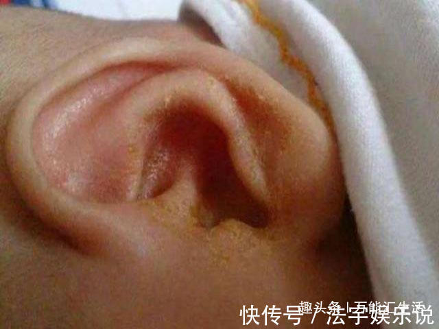 孩子|1岁宝宝老是摸头,妈妈不以为然,检查告知原因父母愧疚