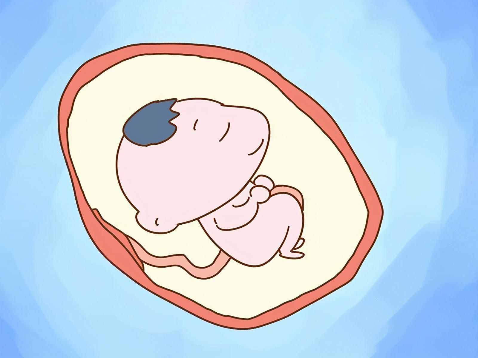 前壁|怀孕两个月,肚子像其他人怀孕四个月一样,是什么原因?