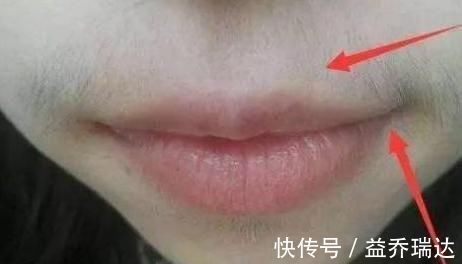 妇科病|女人有妇科病,嘴巴会提前知道,若有此4种表现,不可忽视