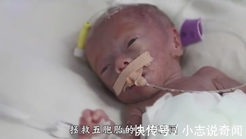 夫妻两人|1.6米孕妇生下五胞胎,最小的孩子只有鸡蛋那么点大,孩子命悬一线